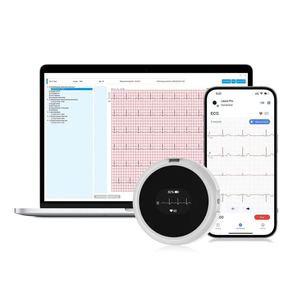 ECG portable à 12 dérivations avec écran OLED CheckMe LepodPro, enregistrement ECG en temps réel pendant 24 heures, marqueurs d'événements